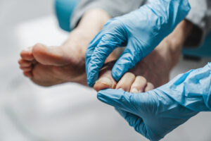 Close-up of a medical professional wearing blue gloves examining a patient's foot, focusing on the toes and nails in a clinical setting."